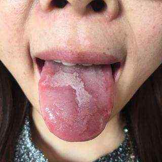 如何看舌苔给宝宝诊病2.jpg 如何看舌苔给宝宝诊病2.jpg