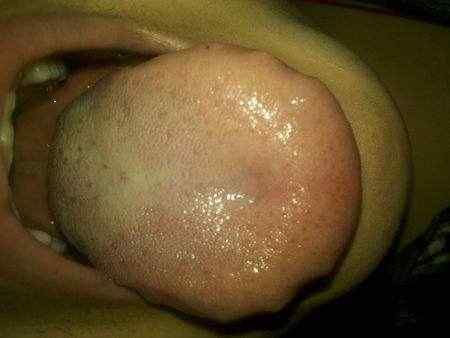 如何看舌苔给宝宝诊病3.jpg 如何看舌苔给宝宝诊病3.jpg