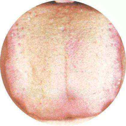 如何看舌苔给宝宝诊病4.jpg 如何看舌苔给宝宝诊病4.jpg