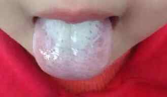 积食内热.jpg 积食内热.jpg