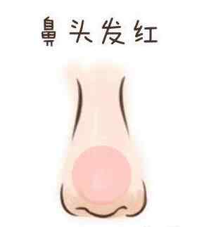 鼻头发红.jpg