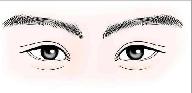 眼睛红肿 眼袋过大是怎么回事？.jpg