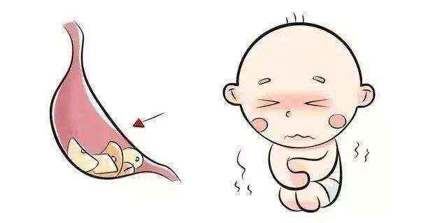 3小孩子怎么预防疳积?.jpg 3小孩子怎么预防疳积?.jpg