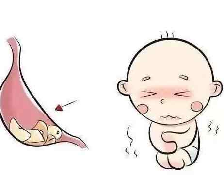 什么是疳积、家长要如何预防孩子疳积？