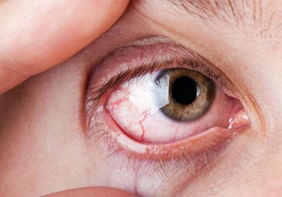 为什么你会肝火旺