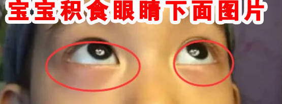 宝宝积食眼睛下面图片、看看你家宝宝有吗？