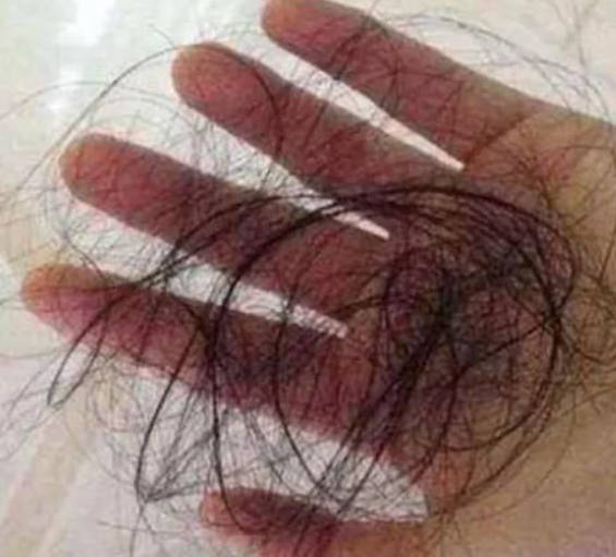 洗头掉头发和以下这5个坏习惯有关