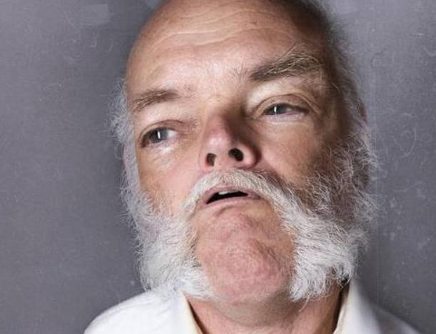 肾亏表现三、身体衰老速率变快