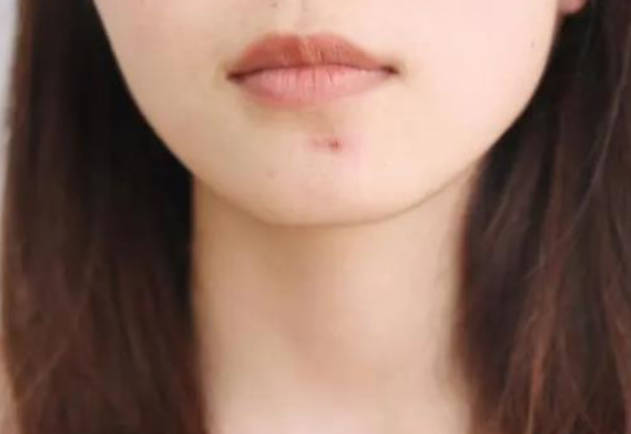 气血不足的3个表现