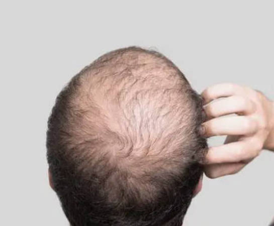 男性身体中3处浓密的部位，它们与肾功能有密切关系