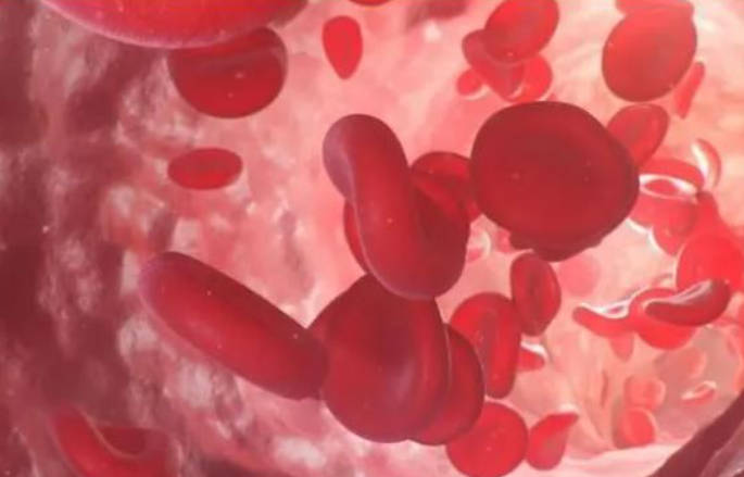 贫血和气血不足的区别