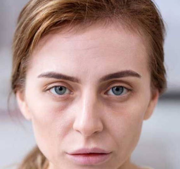 气血不足，气色枯槁，让人缺乏活力，无精打采