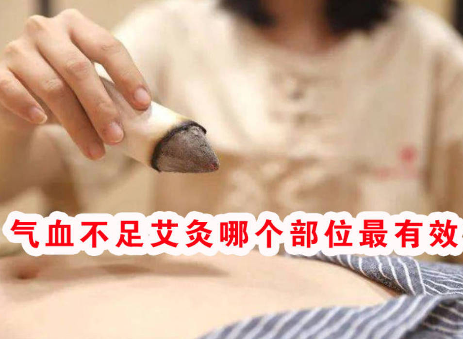 气血不足艾灸哪个部位最有效？这些穴位可以补气血！