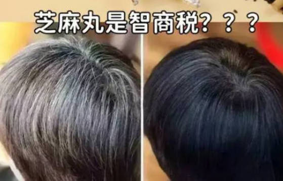 黑芝麻丸对白发有效吗 黑芝麻丸怎么吃治疗白发效果好