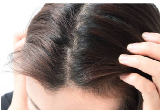 气血不足的10个信号，看看你中了几条？‌