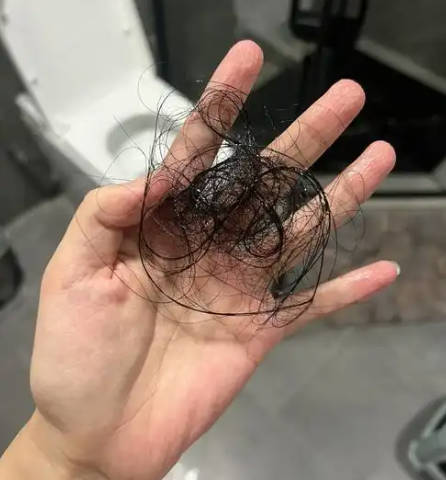 产后妈妈脱发严重，如何有效缓解？