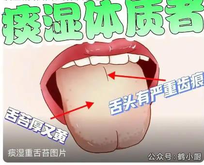 痰湿如何调理最有效的方法.jpg 痰湿如何调理最有效的方法.jpg